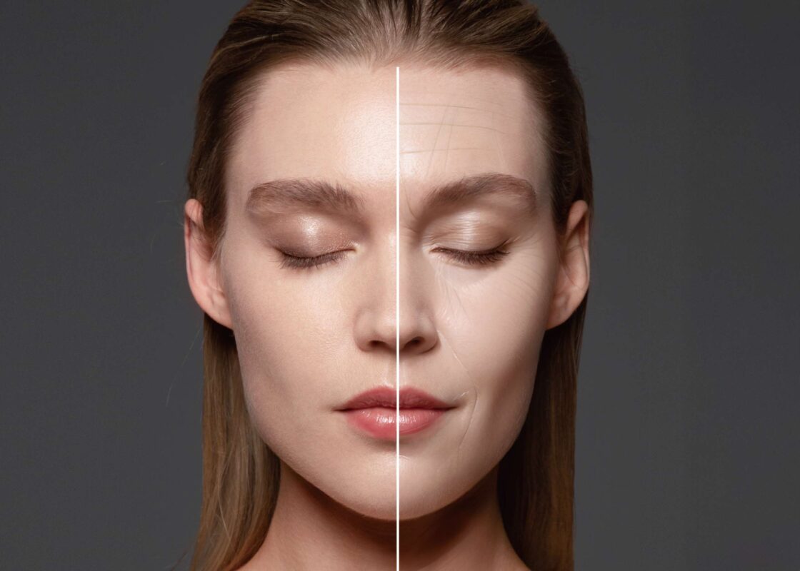 tvar vrasky porovnanie